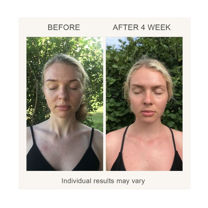 Masque de soin de la peau par luminothérapie LED LUMI