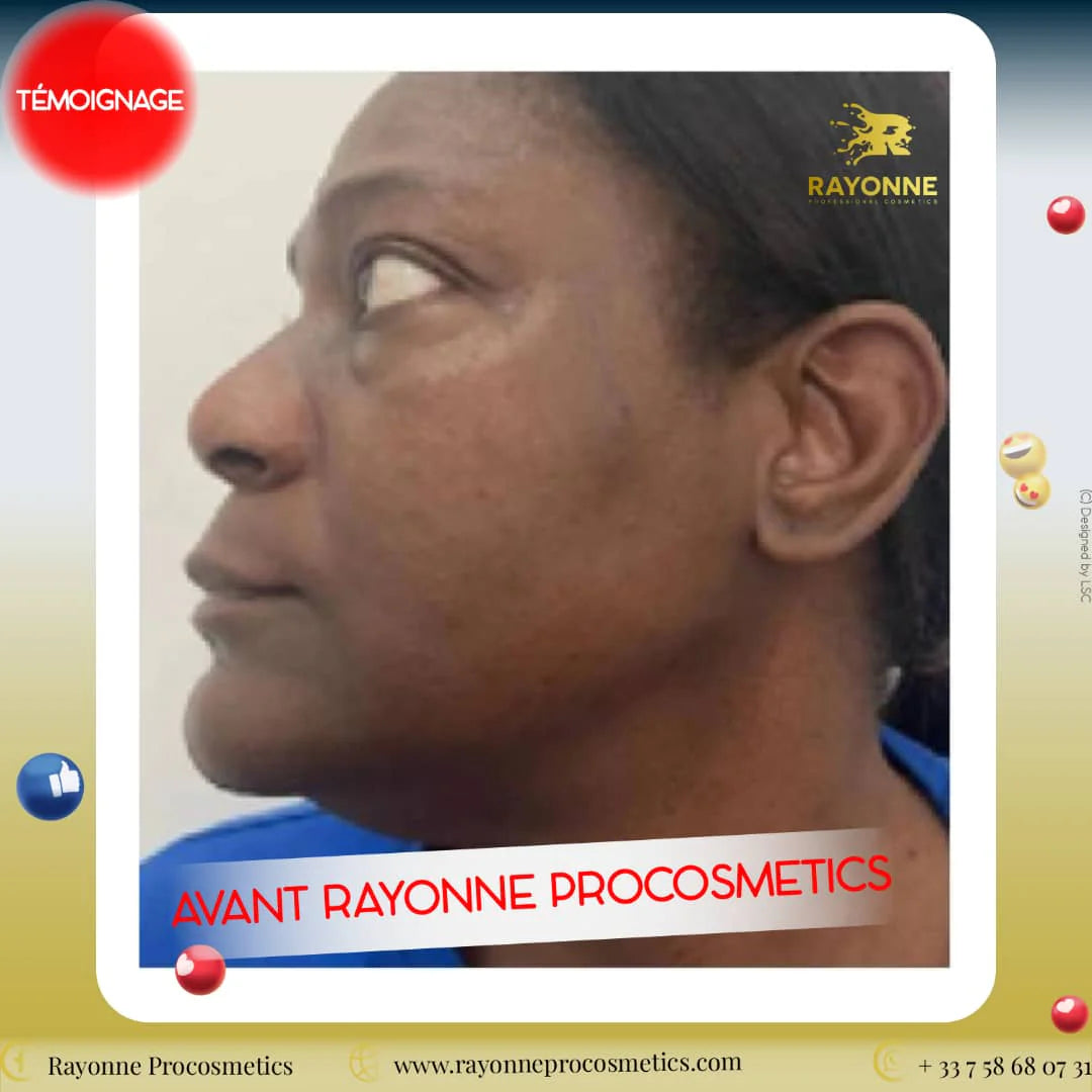 SOIN VISAGE - PACK GOLD EFFICACITÉ RAPIDE